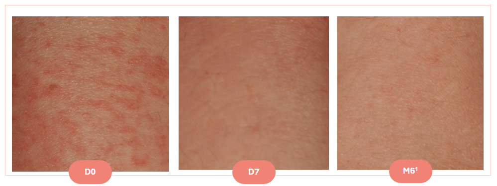 Avant, Après XAD Baume