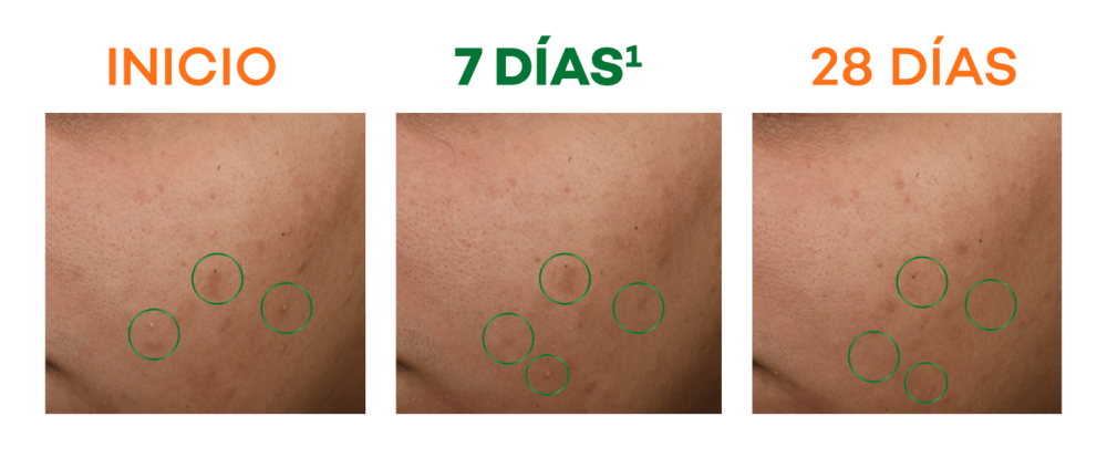 da _actine renov_esquema_enmascaramiento