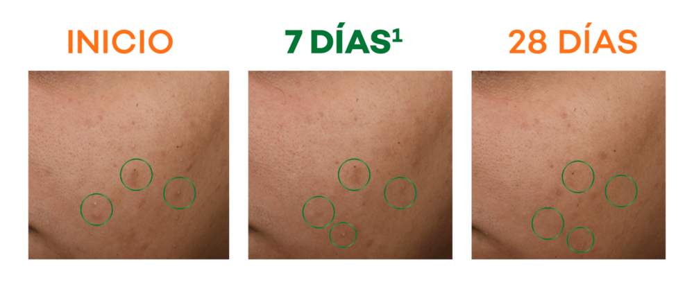 da _actine renov_esquema_enmascaramiento