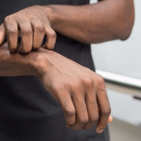 Comment soulager les démangeaisons au quotidien ?