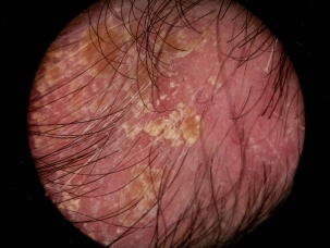 Avant-Après 1 KELUAL DS.jpg