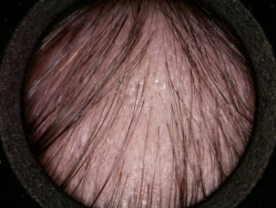 Avant- Après 2 KELUAL DS.jpg