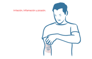 illu-eczema-atopique-03 1.
