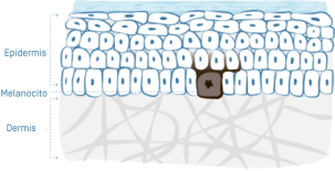 illu-taches-brunes-01 1