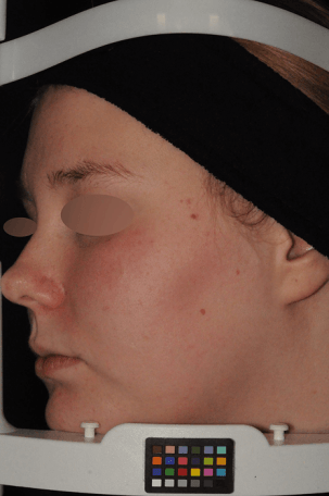 Before P002T01Z13_RV5259A2024034 (1)