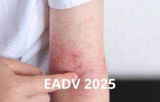Card A-Derma EADV 2025