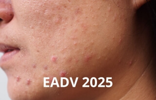 Card Dexeryl EADV 2025