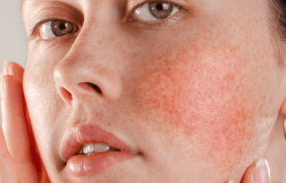 Visuel fiche conseil EXOMEGA Visage