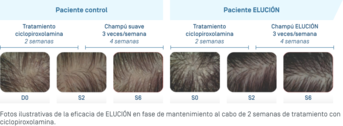 ES-Elution · Photos illustratives.png