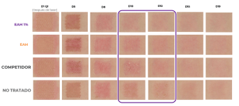 imagerie classique épithéliale ES