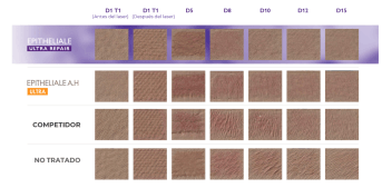 Imagerie 3D epitheliale ES