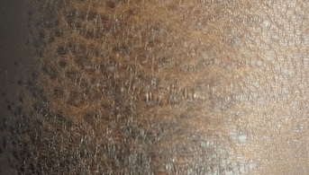 3Fausse ichtyose