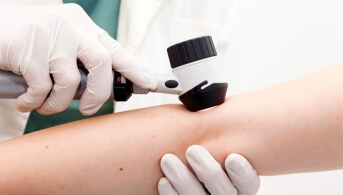 Image dermoscopy header.