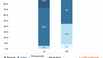 Keracnyl Serum · Sévérité acné