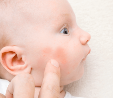 joues rouges bébé large