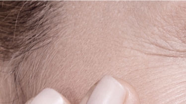 Patho-1440x176-Vieillissement cutané