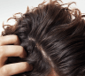 du_kelual ds_original_treatment-shampoo_pathology_4x5