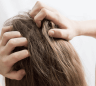 du_sensinol_silo_prurit_scalp_l2_header_icthing scalp 